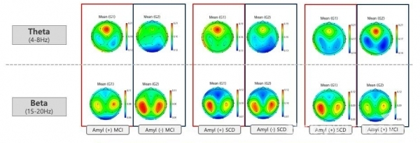 '아이싱크브레인'을 이용해 분석한 결과: 경도인지장애환자(aMCI)의 뇌파 (Photo 아이메디신)